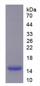 分泌性白细胞蛋白酶抑制因子(SLPI)重组蛋白,Recombinant Secretory Leukocyte Peptidase Inhibitor (SLPI)