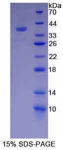 辅肌动蛋白α4(ACTN4)重组蛋白,Recombinant Actinin Alpha 4 (ACTN4)