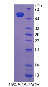 輔酶Q10同源物B(COQ10B)重組蛋白,Recombinant Coenzyme Q10 Homolog B (COQ10B)