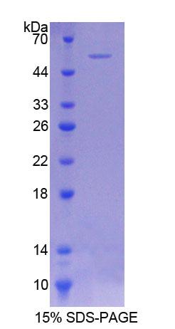 輔酶Q6同源物A(COQ6)重組蛋白,Recombinant Coenzyme Q6 Homolog, Monooxygenase (COQ6)