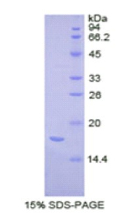 復(fù)合素2(CPLX2)重組蛋白,Recombinant Complexin 2 (CPLX2)