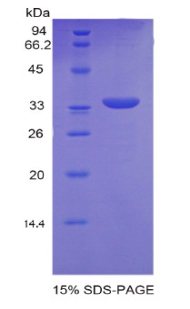 副肿瘤抗原MA2(PNMA2)重组蛋白,Recombinant Paraneoplastic Antigen MA2 (PNMA2)