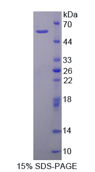 钙蛋白酶2(CAPN2)重组蛋白,Recombinant Calpain 2 (CAPN2)