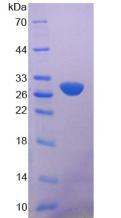 钙非依赖性磷脂酶A2(iPLA2)重组蛋白,Recombinant Phospholipase A2, Calcium Independent (iPLA2)