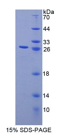钙结合蛋白P22(CHP)重组蛋白,Recombinant Calcium Binding Protein P22 (CHP)