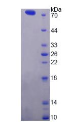 钙离子转运ATP酶B2(ATP2B2)重组蛋白,Recombinant ATPase, Ca++ Transporting, Plasma Membrane 2 (ATP2B2)