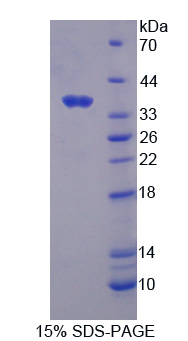 钙敏感受体(CASR)重组蛋白,Recombinant Calcium Sensing Receptor (CASR)