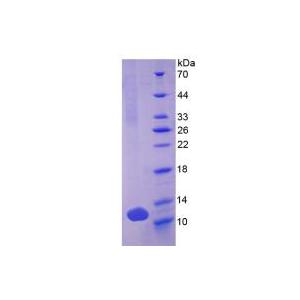 防御素β103A(DEFb103A)重组蛋白