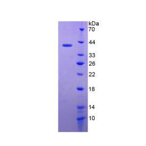 防御素β119(DEFb119)重組蛋白,Recombinant Defensin Beta 119 (DEFb119)