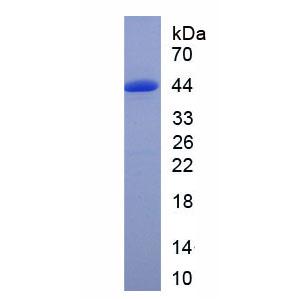 防御素β131(DEFb131)重组蛋白