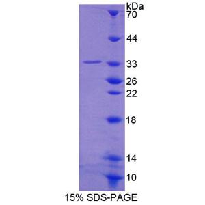 纺锤体蛋白1(SPIN1)重组蛋白