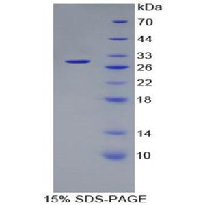 非ATP酶蛋白酶体26S亚基10(PSMD10)重组蛋白,Recombinant Proteasome 26S Subunit, Non ATPase 10 (PSMD10)