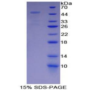 非ATP酶蛋白酶體26S亞基13(PSMD13)重組蛋白,Recombinant Proteasome 26S Subunit, Non ATPase 13 (PSMD13)