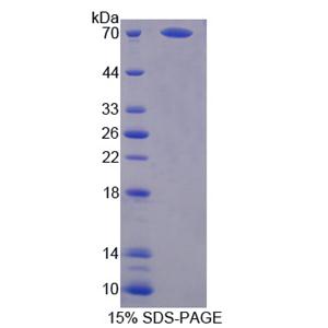 非ATP酶蛋白酶体26S亚基4(PSMD4)重组蛋白