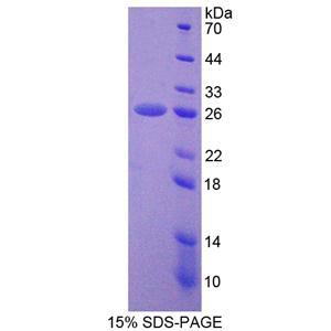 非ATP酶蛋白酶體26S亞基5(PSMD5)重組蛋白,Recombinant Proteasome 26S Subunit, Non ATPase 5 (PSMD5)