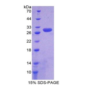 非ATP酶蛋白酶体26S亚基9(PSMD9)重组蛋白