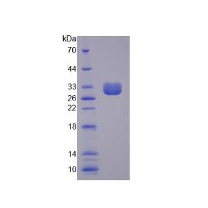 非红细胞血影蛋白β4(SPTbN4)重组蛋白