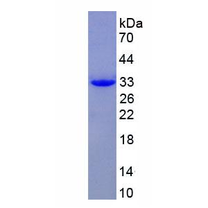 非受体酪氨酸激酶2(TNK2)重组蛋白