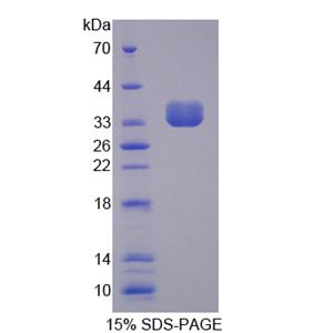 非受体型蛋白酪氨酸磷酸酶6(PTPN6)重组蛋白