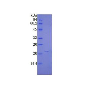 非转移细胞1表达NM23A蛋白(NME1)重组蛋白
