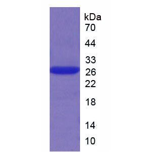 肥大细胞类糜蛋白酶1(CMA1)重组蛋白
