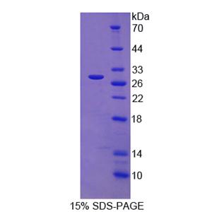 分拣连接蛋白13(SNX13)重组蛋白