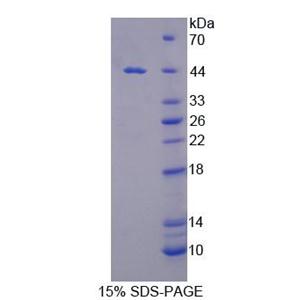 分拣连接蛋白9(SNX9)重组蛋白,Recombinant Sorting Nexin 9 (SNX9)