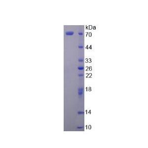 分泌粒蛋白Ⅱ(SCG2)重组蛋白