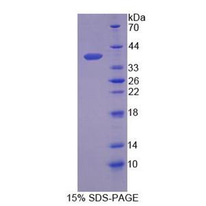 分泌球蛋白家族2A成员2(SCGB2A2)重组蛋白