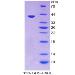 分泌球蛋白家族3A成员2(SCGB3A2)重组蛋白