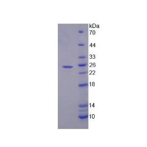 分泌型磷蛋白2(SPP2)重组蛋白