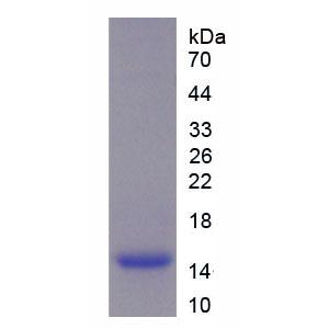 分泌性白细胞蛋白酶抑制因子(SLPI)重组蛋白,Recombinant Secretory Leukocyte Peptidase Inhibitor (SLPI)