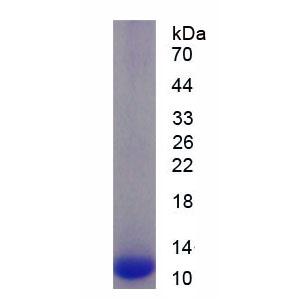 封闭蛋白18(CLDN18)重组蛋白