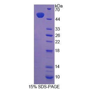 輔酶Q10同源物B(COQ10B)重組蛋白