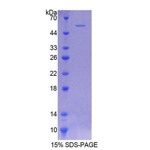 輔酶Q6同源物A(COQ6)重組蛋白,Recombinant Coenzyme Q6 Homolog, Monooxygenase (COQ6)