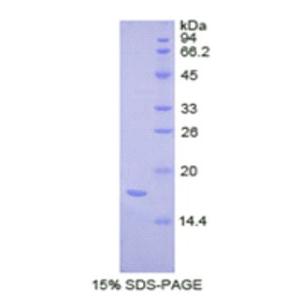 复合素2(CPLX2)重组蛋白