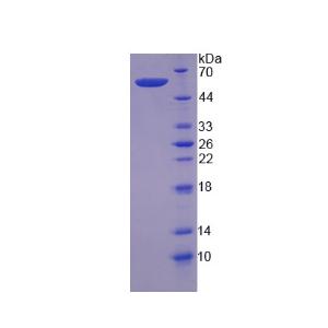 鈣蛋白酶6(CAPN6)重組蛋白,Recombinant Calpain 6 (CAPN6)