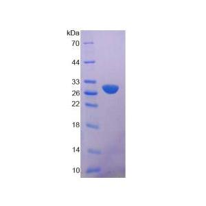 钙非依赖性磷脂酶A2(iPLA2)重组蛋白
