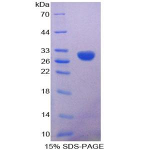 钙结合蛋白(CR)重组蛋白,Recombinant Calretinin (CR)