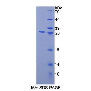钙结合蛋白P22(CHP)重组蛋白