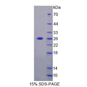 钙黏蛋白23(CDH23)重组蛋白