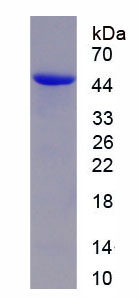 钙调蛋白1(CALM1)重组蛋白,Recombinant Calmodulin 1 (CALM1)