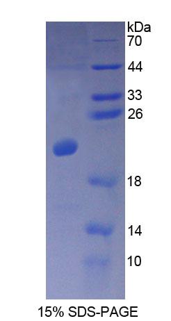 钙调蛋白样蛋白3(CALML3)重组蛋白,Recombinant Calmodulin Like Protein 3 (CALML3)