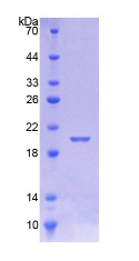 钙调蛋白样蛋白5(CALML5)重组蛋白,Recombinant Calmodulin Like Protein 5 (CALML5)