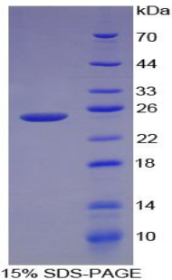 钙调结合蛋白(CALD)重组蛋白,Recombinant Caldesmon (CALD)