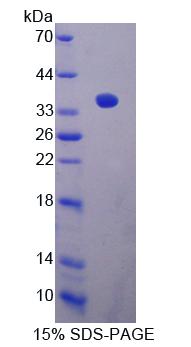 钙调磷酸酶结合蛋白1(CABIN1)重组蛋白,Recombinant Calcineurin Binding Protein 1 (CABIN1)