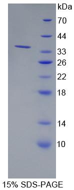 钙同线蛋白2(CLSTN2)重组蛋白,Recombinant Calsyntenin 2 (CLSTN2)