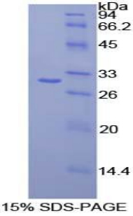 钙粘蛋白EGF LAG七经G-型受体2(CELSR2)重组蛋白,Recombinant Cadherin EGF LAG Seven Pass G-Type Receptor 2 (CELSR2)