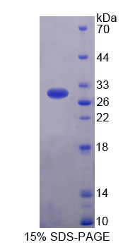 钙粘蛋白EGF LAG七经G-型受体3(CELSR3)重组蛋白,Recombinant Cadherin EGF LAG Seven Pass G-Type Receptor 3 (CELSR3)