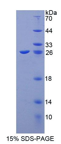 钙整合素结合蛋白1(CIB1)重组蛋白,Recombinant Calcium And Integrin Binding Protein 1 (CIB1)